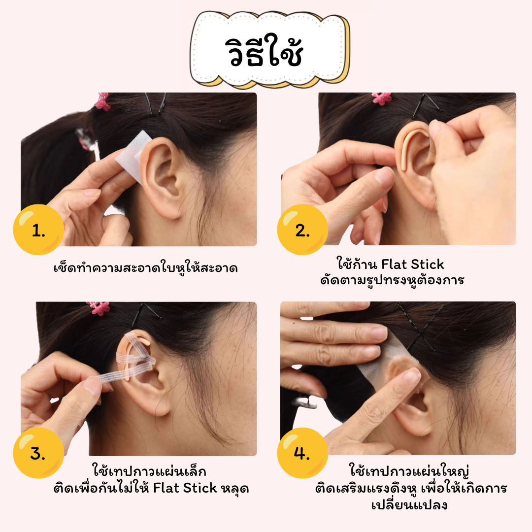 Flat Stick ก้านซิลิโคนปรับรูปทรงหู สำหรับเด็ก แก้ไขปัญหาใบหูพับ / ผิดรูป_OP039