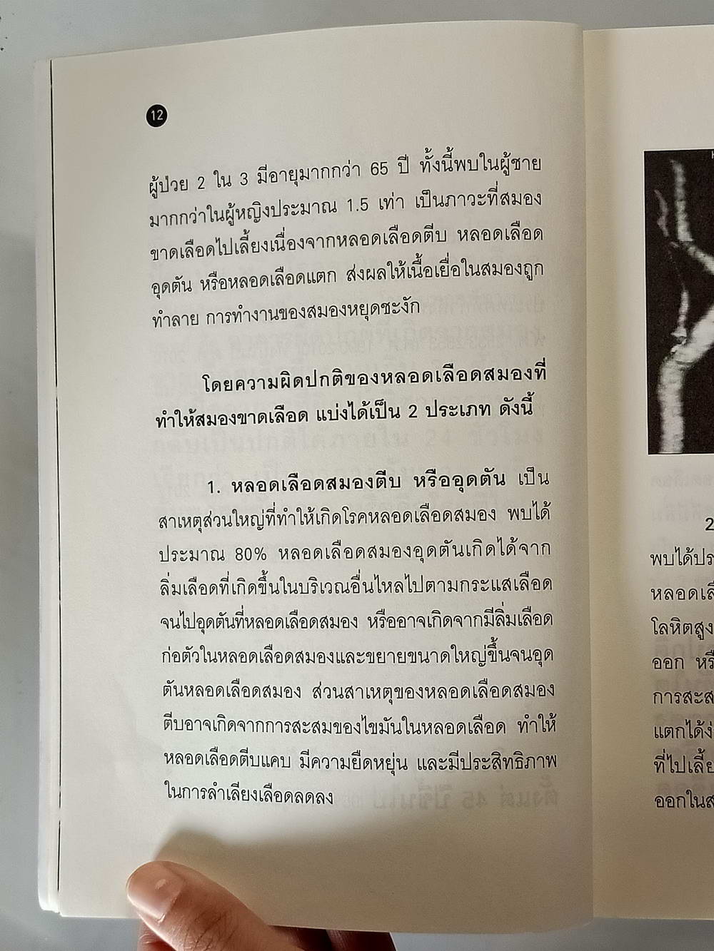 หนังสือมือสอง 174 "ฮือฮาสูตรยาหมอเบิร์ดทางเส้นเลือดให้เรียกใช้ใน 3 เดือน" โรคเส้นเลือดในสมองตีบ อัมพฤกษ์ อัมพาต สามารถรักษาได้ด้วยสมุนไพรไทยเพียง 3 ขนานความหนา 152 หน้า