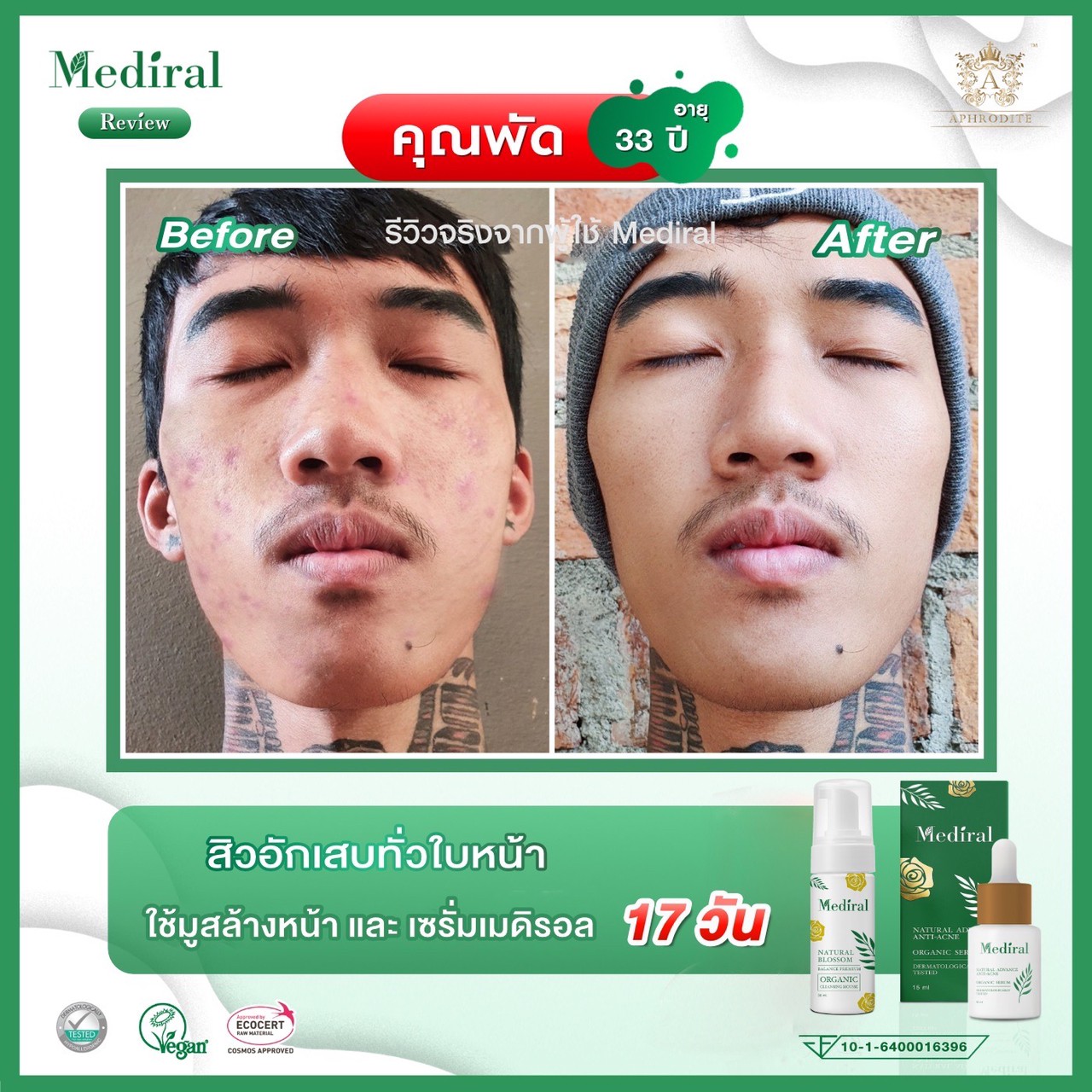 Mediral เซรั่มปราบสิว ผิวนุ่มชุ่มชื้น Natural Advance Anti Acne ชิ้น