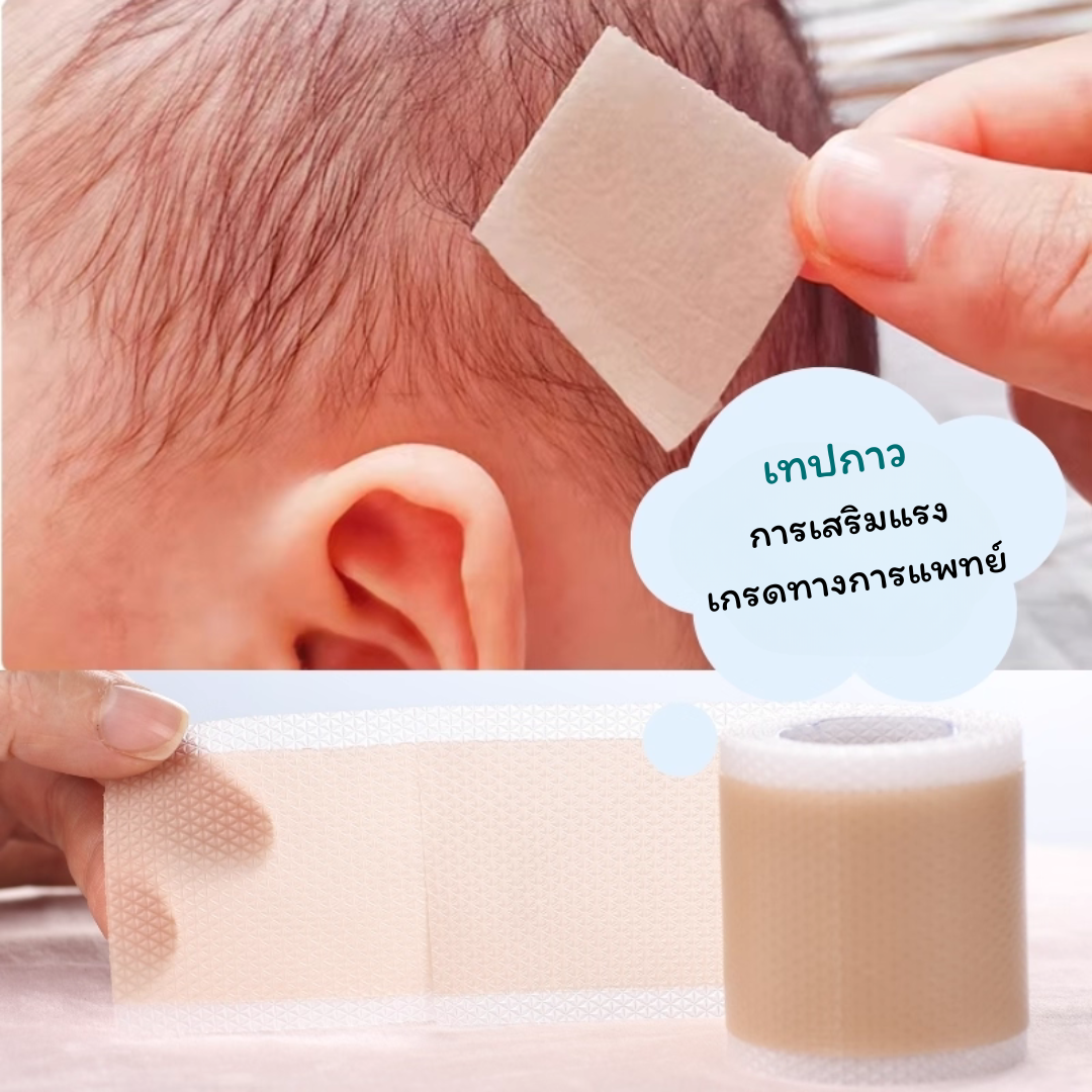 Flat Stick ก้านซิลิโคนปรับรูปทรงหู สำหรับเด็ก แก้ไขปัญหาใบหูพับ / ผิดรูป_OP039