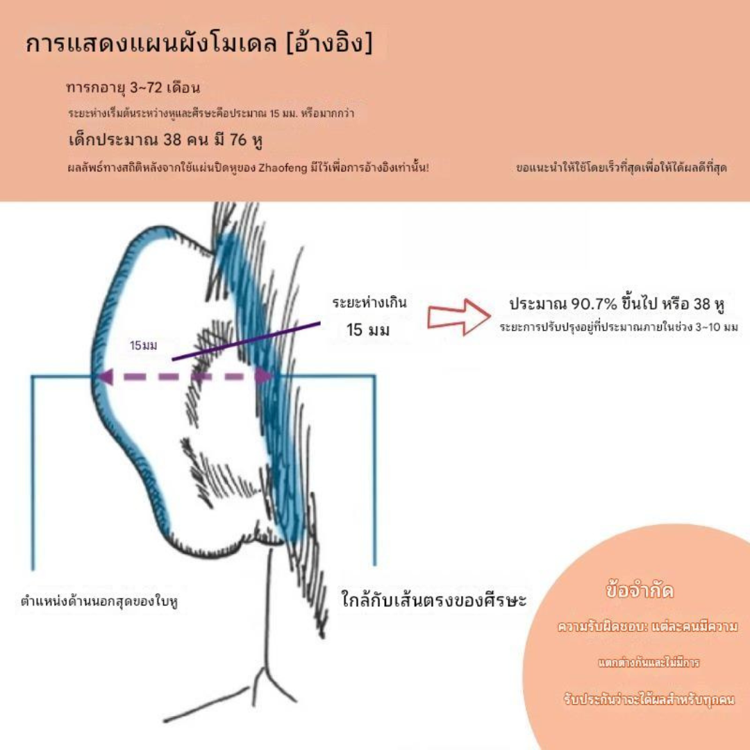 แก้ปัญหาหูกางด้วย Ear flat สำหรับเด็ก พร้อมส่ง (ตัวแทนจำหน่ายในไทย)_OP017K