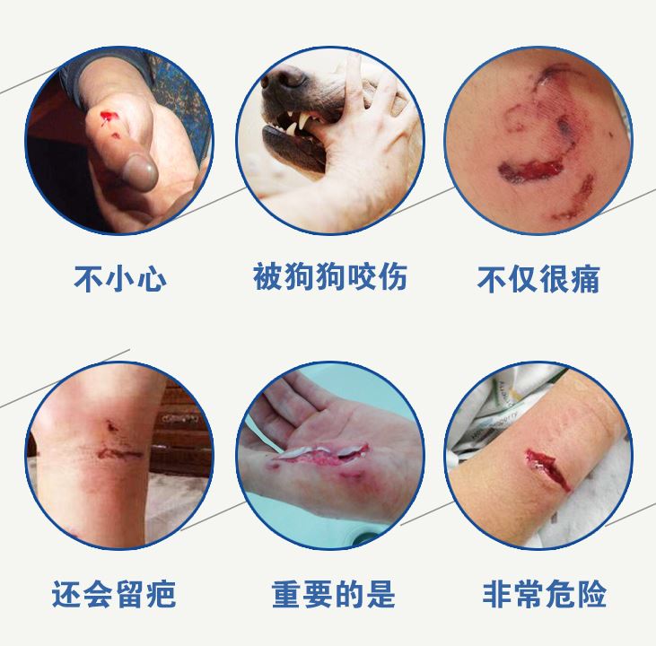 OT102 ถุงมือหนังยาวพิเศษ หนังนุ่ม กันสัตว์กัด ข่วน งานเชื่อม งานช่างต่างๆ