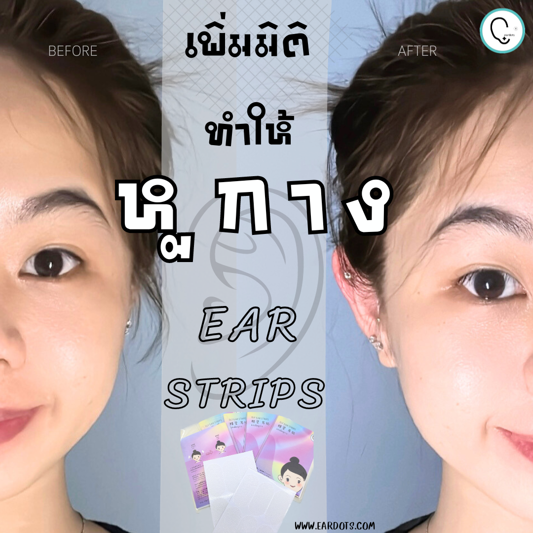 แผ่นติดทำให้หูกาง ดูมีมิติ ไม่ลีบแบน ELF EAR STRIPS