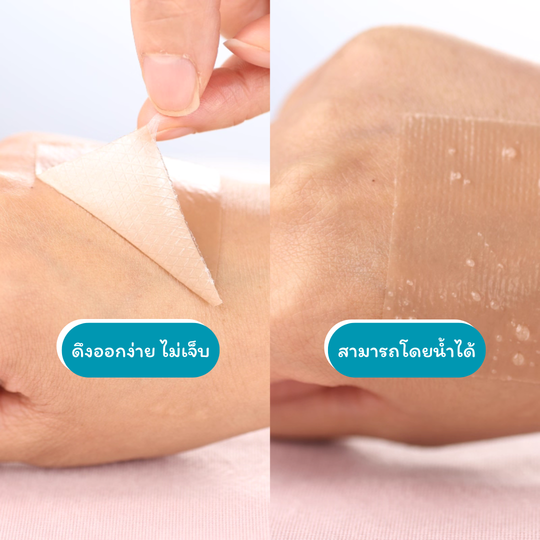 Flat Stick ก้านซิลิโคนปรับรูปทรงหู สำหรับเด็ก แก้ไขปัญหาใบหูพับ / ผิดรูป_OP039