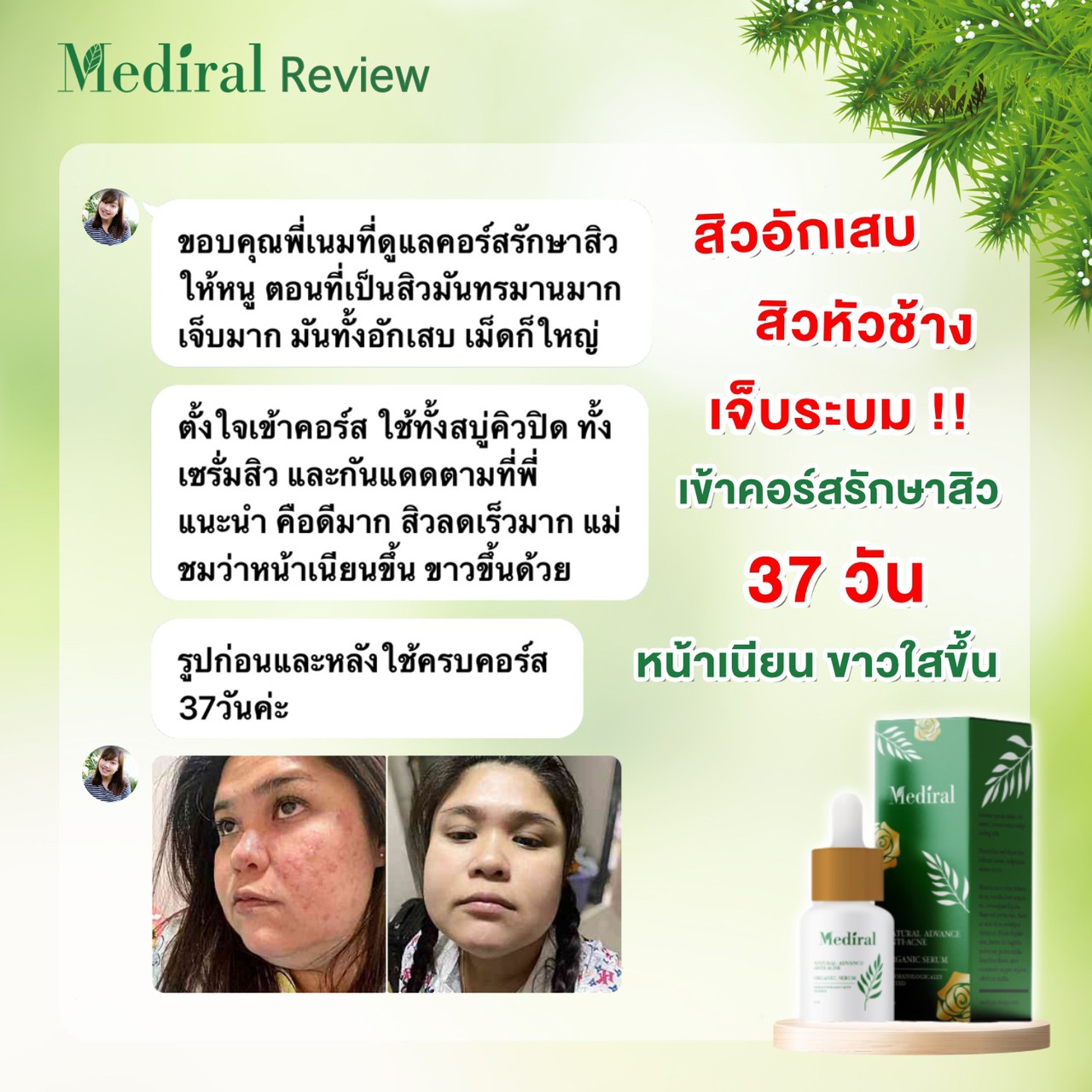 Mediral เซรั่มปราบสิว ผิวนุ่มชุ่มชื้น Natural Advance Anti Acne ชิ้น