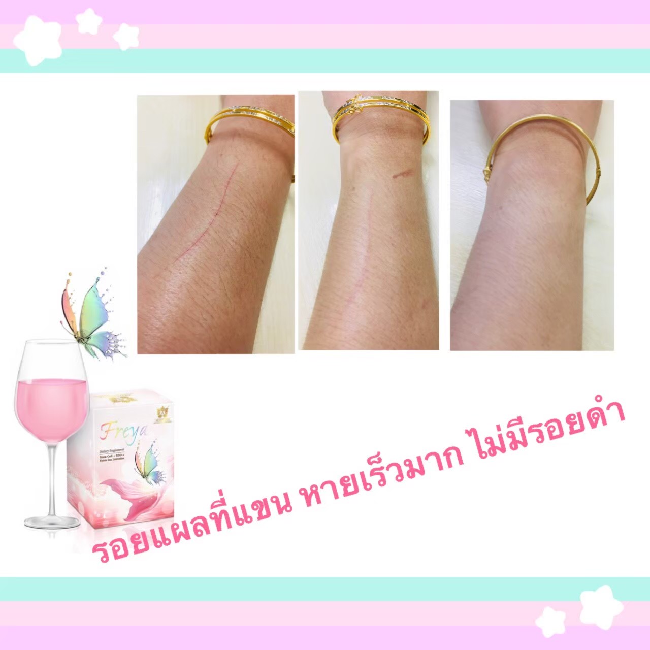 Freya (เฟรญ่า) วิตามินผิวชงดื่มเข้มข้นเพื่อคนผิวมัน กล่อง