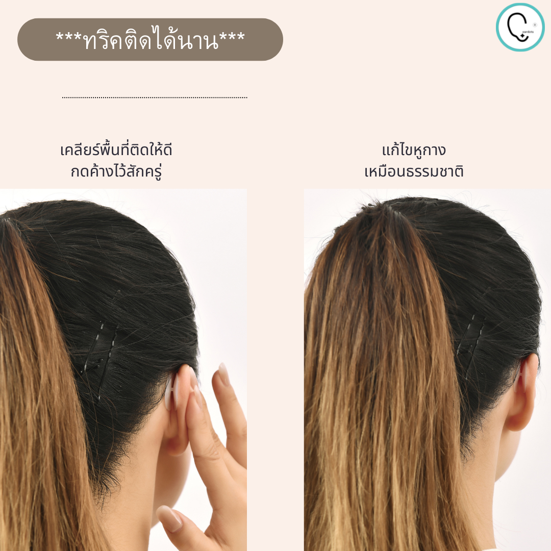 พร้อมส่งจากไทย แก้ปัญหาหูกางด้วย Ear flat ปรับปรุงใหม่เนียนใส/บางกว่าเดิม ใช้คู่กับกาวรียูส(ตัวแทนจำหน่ายในไทย)_OP017