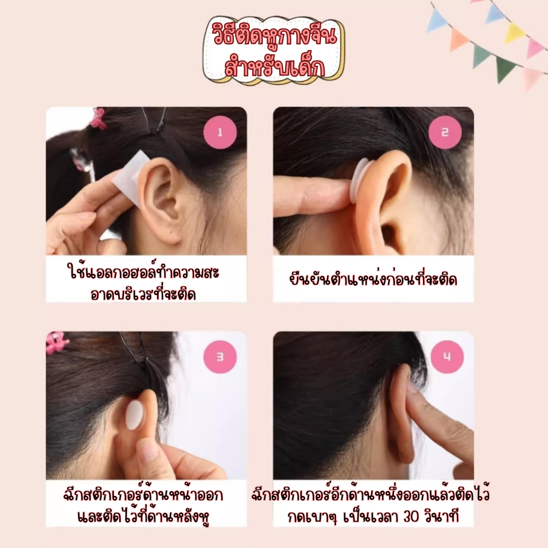 พร้อมส่งจากไทย แก้ปัญหาหูกางด้วย Ear flat ปรับปรุงใหม่เนียนใส/บางกว่าเดิม ใช้คู่กับกาวรียูส(ตัวแทนจำหน่ายในไทย)_OP017
