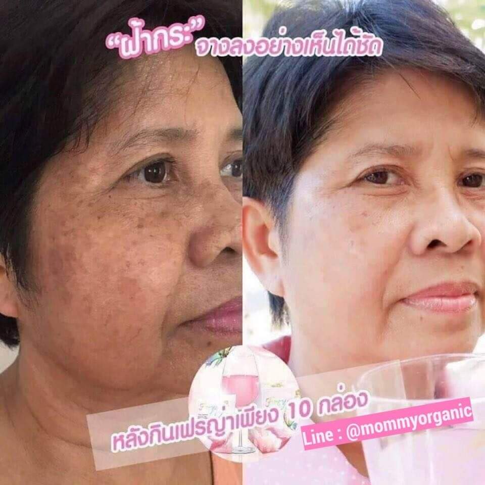 Freya (เฟรญ่า) วิตามินผิวชงดื่มเข้มข้นเพื่อคนผิวมัน กล่อง