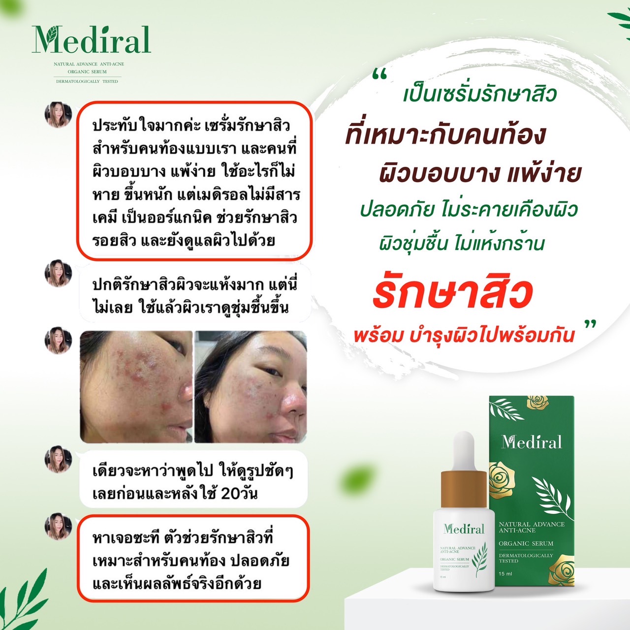 Mediral เซรั่มปราบสิว ผิวนุ่มชุ่มชื้น Natural Advance Anti Acne ชิ้น