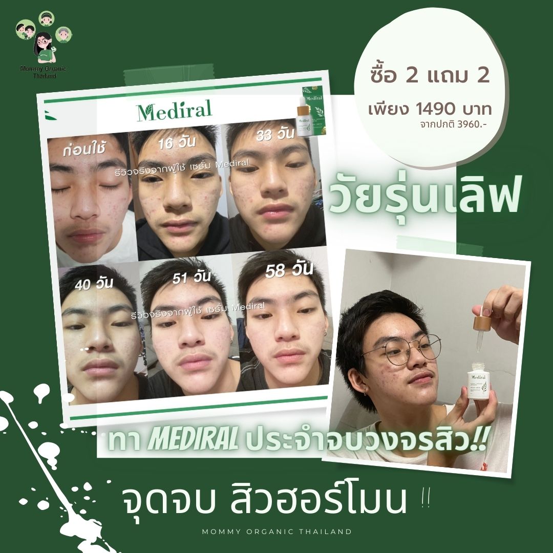 Mediral เซรั่มปราบสิว ผิวนุ่มชุ่มชื้น Natural Advance Anti Acne ชิ้น