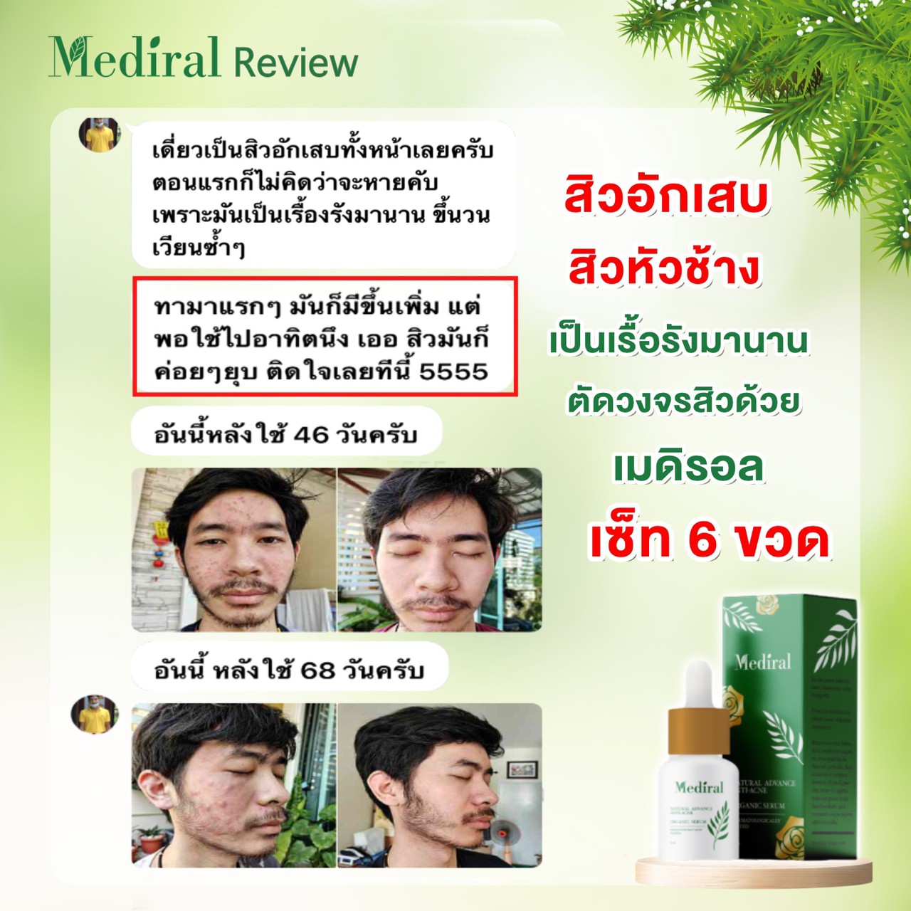 Mediral เซรั่มปราบสิว ผิวนุ่มชุ่มชื้น Natural Advance Anti Acne ชิ้น
