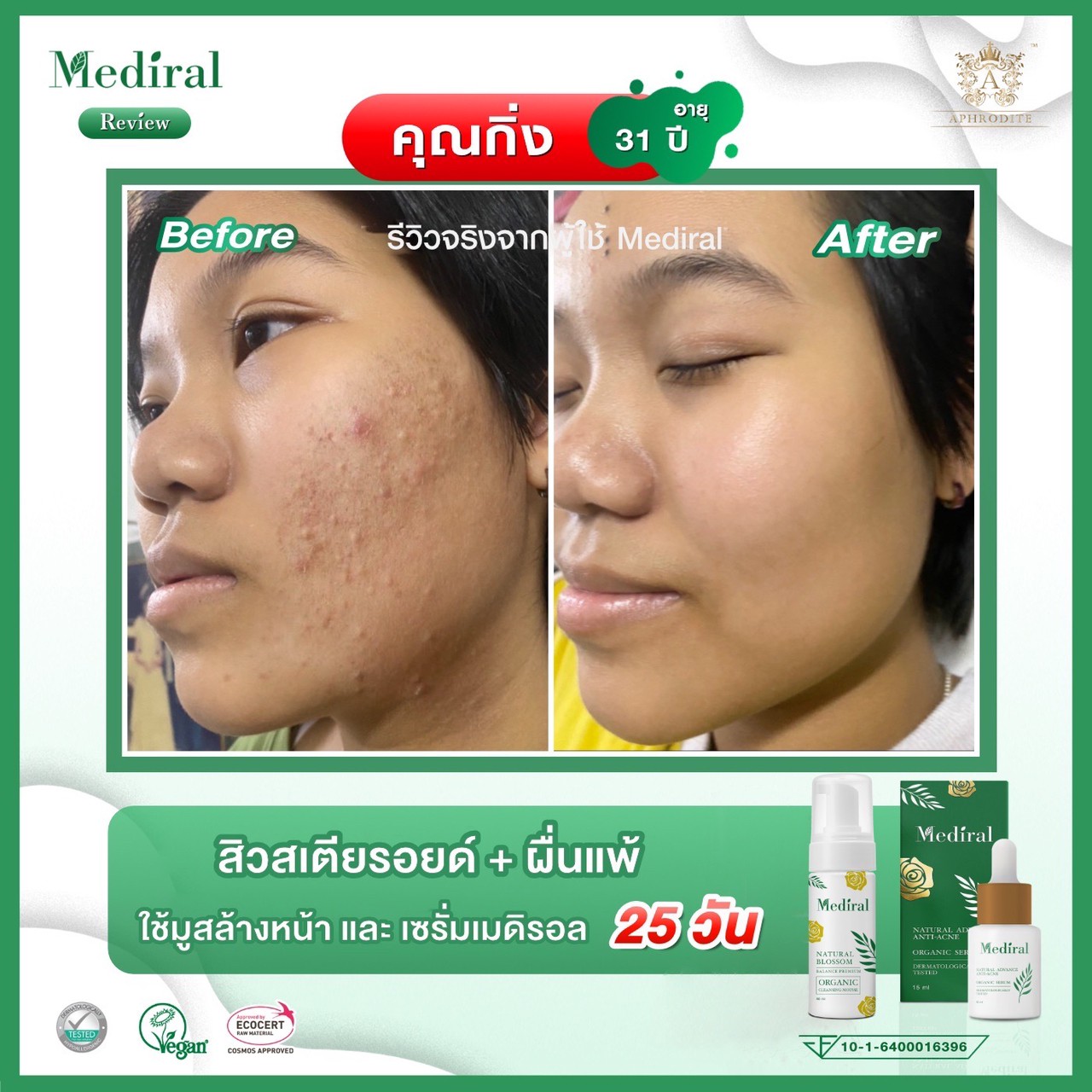 Mediral เซรั่มปราบสิว ผิวนุ่มชุ่มชื้น Natural Advance Anti Acne ชิ้น