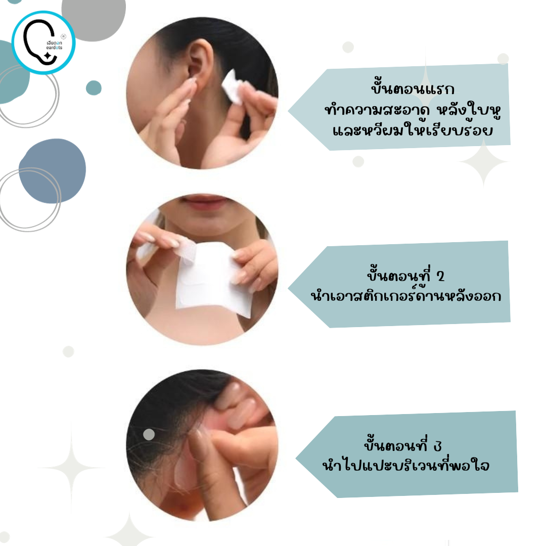 แผ่นติดทำให้หูกาง ดูมีมิติ ไม่ลีบแบน ELF EAR STRIPS