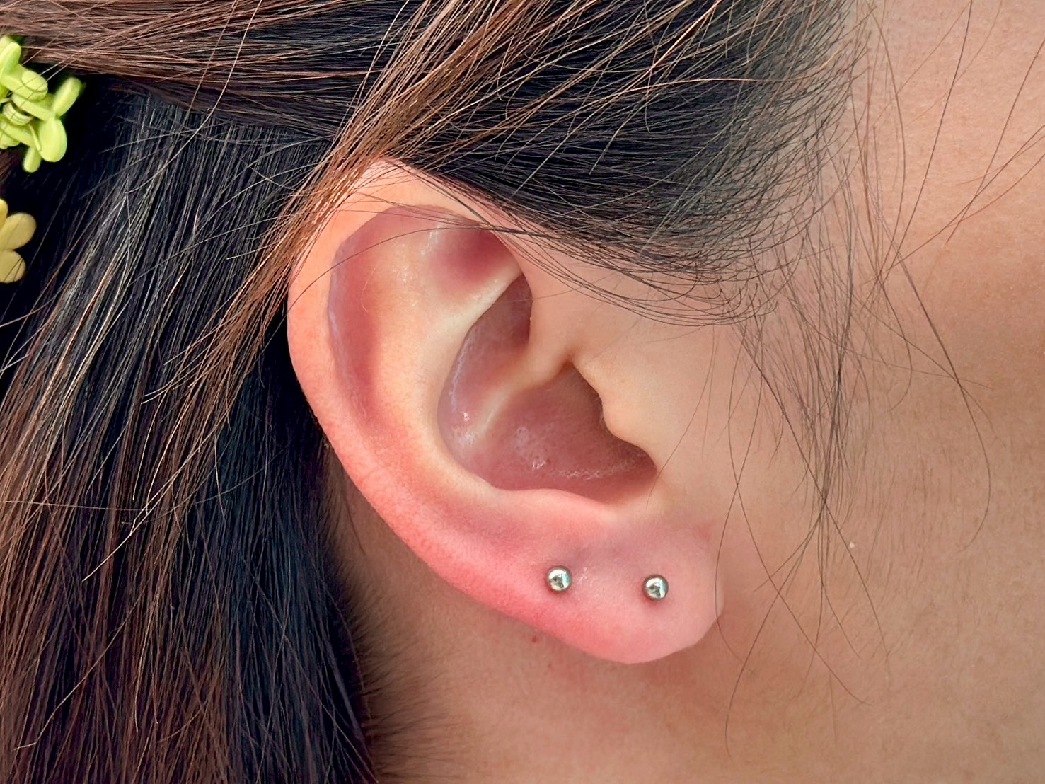 FT MD3_Ti 3mm Ball
