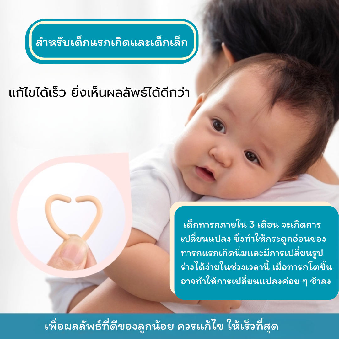 Flat Stick ก้านซิลิโคนปรับรูปทรงหู สำหรับเด็ก แก้ไขปัญหาใบหูพับ / ผิดรูป_OP039