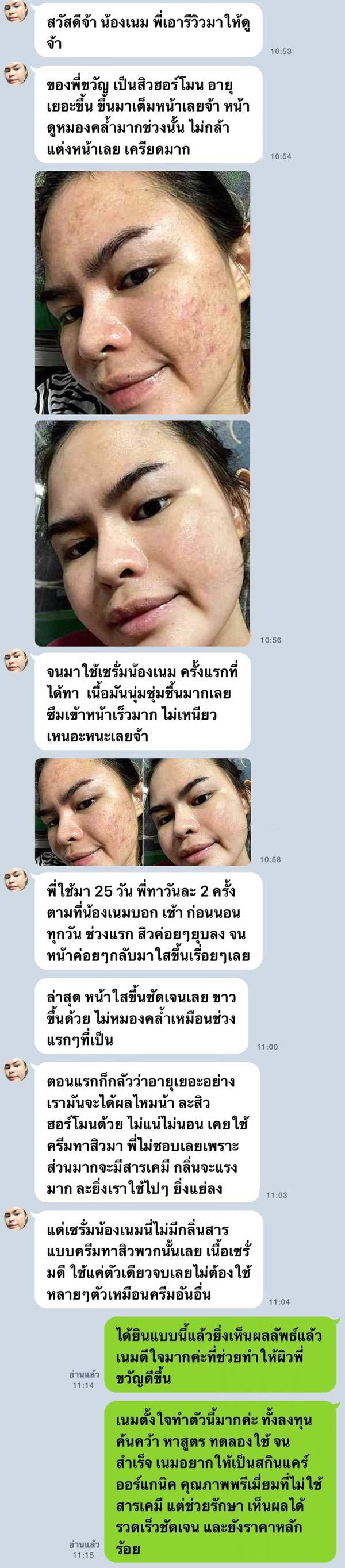 Mediral เซรั่มปราบสิว ผิวนุ่มชุ่มชื้น Natural Advance Anti Acne ชิ้น