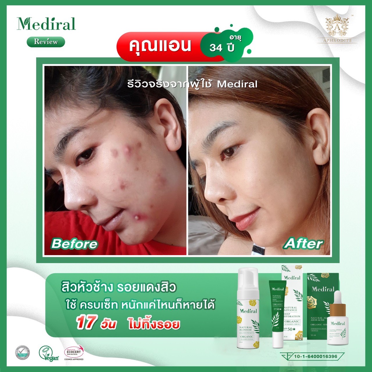 Mediral เซรั่มปราบสิว ผิวนุ่มชุ่มชื้น Natural Advance Anti Acne ชิ้น