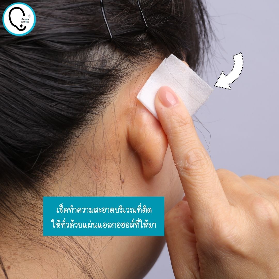 พร้อมส่งจากไทย แก้ปัญหาหูกางด้วย Ear flat ปรับปรุงใหม่เนียนใส/บางกว่าเดิม ใช้คู่กับกาวรียูส(ตัวแทนจำหน่ายในไทย)_OP017