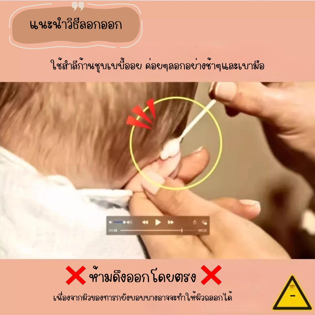 พร้อมส่งจากไทย แก้ปัญหาหูกางด้วย Ear flat ปรับปรุงใหม่เนียนใส/บางกว่าเดิม ใช้คู่กับกาวรียูส(ตัวแทนจำหน่ายในไทย)_OP017