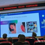 แบ่งปันความรู้เรื่องคีลอยด์จากงาน The 5th International Keloid Symposium