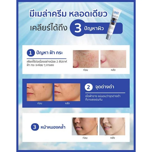 Yanhee Mela Cream ยันฮี เมล่า ครีม ครีมบำรุงผิวหน้า ดูแลฝ้า กระ จุดด่างดำ image 5 Yanhee Mela Cream ยันฮี เมล่า ครีม ครีมบำรุงผิวหน้า ดูแลฝ้า กระ จุดด่างดำ image 5